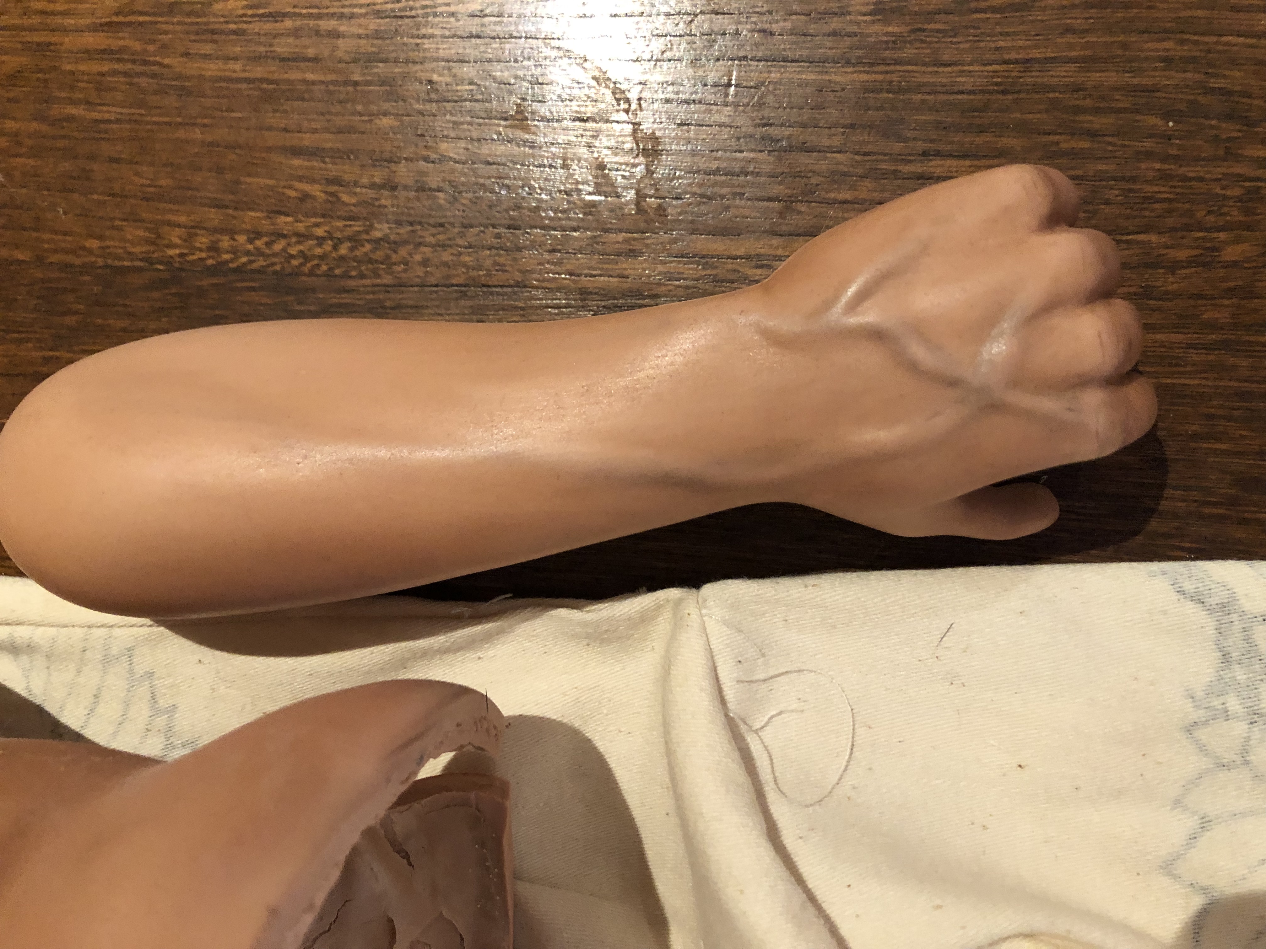 arm
